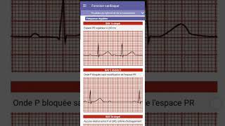 13 Le guide IADE les grandes fonctions [upl. by Latnahc]