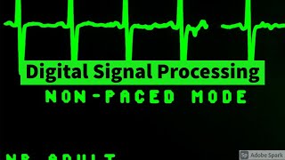 DSP  L8  Solving 8 point DFT of a time domain sequence with its magnitude and phase angle [upl. by Togram]