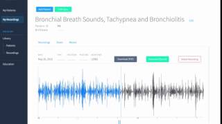 Bronchial Breath Sounds Tachypnea and Bronchiolitis Recording amp Waveform  Eko Health [upl. by Aterg437]