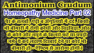 Antimonium Crudum  Homeopathic Medicine  Part 02 bydrncghosh [upl. by Turino379]