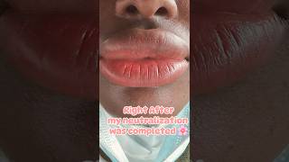 My Lip Neutralization UPDATE liptattoo lips lipblushing lipblushtattoo lipblush fypviral [upl. by Ettenan18]