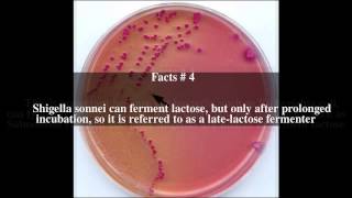 SorbitolMacConkey agar Top  8 Facts [upl. by Adanama]