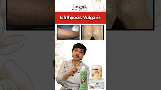 Ichthyosis Vulgaris skincare healthyskin selfcare ichthyosis skincaretips skin deadskincells [upl. by Johann]