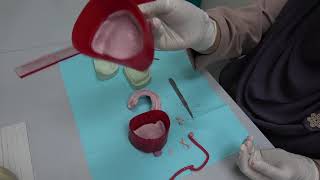 COMPLETE DENTURE 3 Preparation of Working Cast [upl. by Rramo]