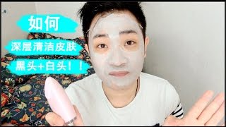 如何深层清洁皮肤黑头、白头  deep cleansing mask  How to remove blackhead [upl. by Marigolde]