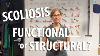 Functional vs Structural Scoliosis by Irvine Posture Doc [upl. by Iliram485]