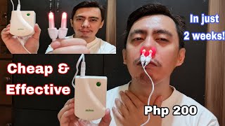 BIONASE RHINITIS SINUSITIS NOSE THERAPY LED LIGHT  ANG CHEAP  EFFECTIVE BA NURSE REAL TALK REVIEW [upl. by Atikihc]