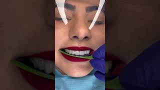 Does anyone know why people bite filmfullingDIYdentist badbreath shame🦷beadrepair [upl. by Xenophon]