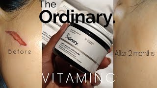 THE ORDINARY 100 LASCORBIC ACID POWDER REVIEW AND HOW TO USE IT [upl. by Xonnel545]