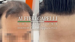 Chuck Alfieri Capelli Hair and Hairline Replacement Men amp Women [upl. by Ellened898]