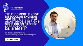 Comprehensive Mesocolon Excision and Intracorporeal Anastomosis in Right Sided Colon Cancer [upl. by Bahe]