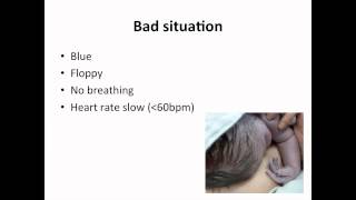 Paediatrics  neonatal resuscitation [upl. by Adnala]