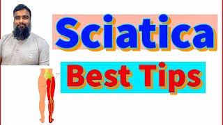 sciatica treatment  Sciatica pain relief  Herniated Disc  Sciatica problem and physiotherapy [upl. by Meean]