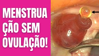 É Possível MENSTRUAR sem ter OVULAÇÃO  Uma mulher pode OVULAR e não MENSTRUAR  Dra Neide Pires [upl. by Adelaide]