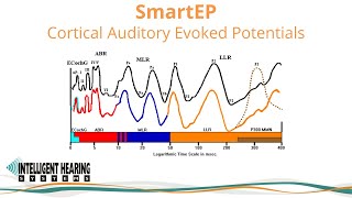 SmartEP Overview of Cortical Auditory Evoked Potential options [upl. by Llesig713]