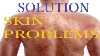 SOLUTION FOR SKIN PROBLEMS  SNHealthCare [upl. by Novi]