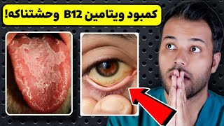 شوکه کننده کمبود ویتامین B12 چه تاثیر وحشتناکی روی بدن میذاره؟ [upl. by Sulakcin]