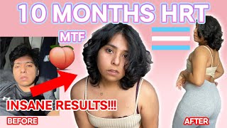 10 MONTHS ON HORMONES  CURVES  FACE CHANGES 🍑👀 MTF INSANE RESULTS [upl. by Mulloy]