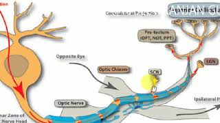 OPTIC NERVE  Ophthalmology  1 [upl. by Helali]