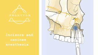 Incisors and canines anesthesia  local anesthesia of the upper jaw [upl. by Wyon]