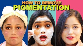 How to remove Pigmentation Naturally😯कितने भी गहरे दाग धब्बे हो सब गायब Remove Dark spots Acnes [upl. by Siravrat]