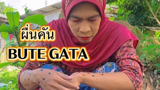 ผื่นคัน BUTE GATA [upl. by Mikiso125]