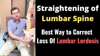 Straightening of Lumbar Spine Loss of Lumbar Lordosis Treatment How to Correct Lumbar Curvature [upl. by Darnell]