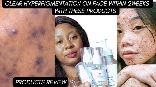 4 NATURAL PRODUCTS TO CLEAR HYPERPIGMENTATION ACNE SCARS SUNBURN MELASMA DARK SPOTSON THE FACE [upl. by Braca]