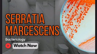 Serratia marcescens Characteristics Diseases Pathogenicity amp Clinical Implications  Bacteriology [upl. by Aerdnaxela]