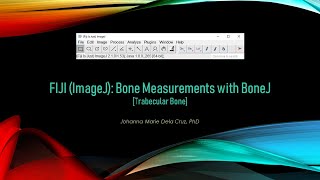 FIJI ImageJ Bone Analysis with BoneJ2 Trabecular Bone [upl. by Godliman588]