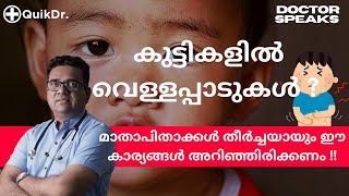 കുട്ടികളുടെ മുഖത്ത് വരുന്ന വെള്ളപ്പാടിന്റെ കാരണങ്ങളും പരിഹാരവും White Patches on Baby s Face [upl. by Mareah]