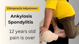 Ankylosing Spondylitis  Symptoms and Treatment Rheumatologist [upl. by Esinaj]