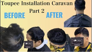 Toupee Installation Caravan Part 2  Toupee Installation Baguio City  Toupee hair system [upl. by Rehpotisrhc]