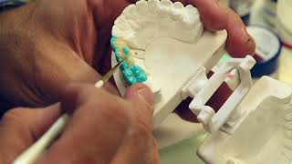 Dentaurum ceramotion zr  Nacera zirconia  One Touch 3D 2D pastes Bassam Haddad [upl. by Airoled]