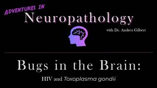 Bugs in the Brain  HIV and Toxoplasmosis [upl. by Cirdek]