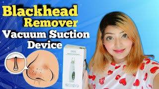 How To Use Blackhead Vacuum Suction Machine  blackhead pore vacuum  Does it Work [upl. by Lubbock]