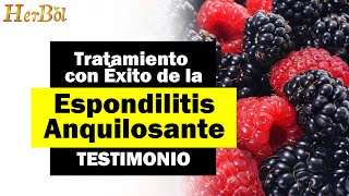 Espondilitis anquilosante tratamiento natural ─ TESTIMONIO Naturismo Herbol [upl. by Akerue792]