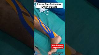 Kinesio taping for improve lymphatic drainage How to reduce edema kinesiotape kinesiotherapy [upl. by Kyte]