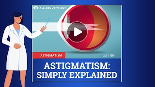 What Is Astigmatism and What Are the Symptoms [upl. by Nievelt]