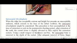 preprosthetic surgical considrations [upl. by Ayam]