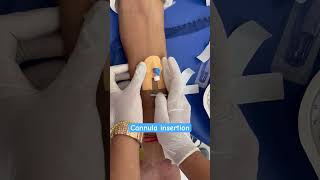 Cannula insertion of male patient nurses doctor cannula neet mbbs shorts subscribe youtube [upl. by Faucher]