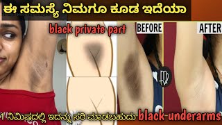 Home Remedy Tips UnderArms Whitening Rid Dark Spots amp Patches Skincare tip [upl. by Safier206]