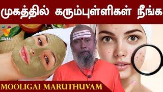 முகத்தில் உள்ள கரும்புள்ளிகள் நீங்க இயற்கை வைத்தியம்  Black Marks Removal Treatment on Face [upl. by Neerual]