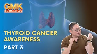 Thyroid Cancer Awareness Part 33  Usapang Pangkalusugan [upl. by Ahsinehs]