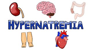 An Approach to Hypernatremia  Hypernatremia Diagnostic Algorithm  Hypernatremia Causes MADE EASY [upl. by Ennahs]