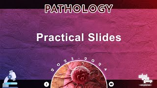 Pract Slides of locomotor system Pathology [upl. by Nylasoj]