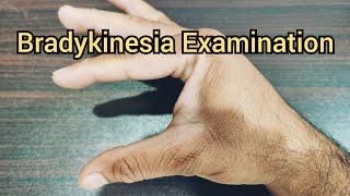 How to Examine a Patient for Bradykinesia  Parkinsonism [upl. by Notnek]