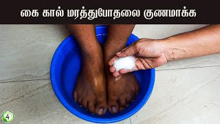 கை கால் மரத்துபோக காரணமும் அதற்கான வீட்டுவைத்தியமும்  Numbness home remedy [upl. by Graehl]