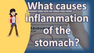 What causes inflammation of the stomach   Health FAQs [upl. by Drawd]