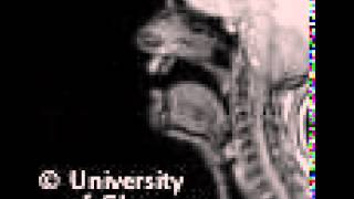 MRI voiceless alveolar lateralfricative [upl. by Nwahsel864]